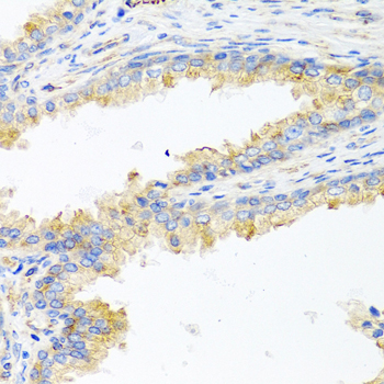 A0304_IHC_01_(8598).jpg