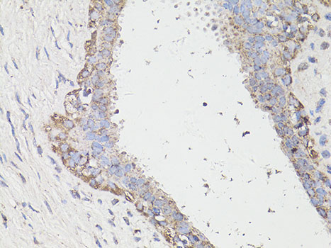 A15591_IHC_01_(23574).jpg